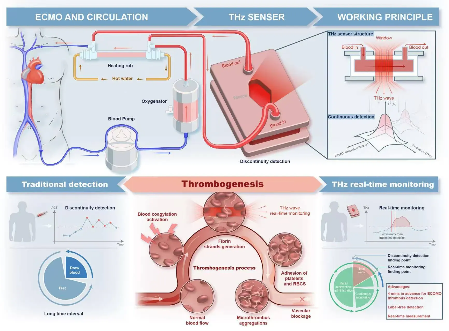 Mechanism diagram combining an ECMO monitoring system with the process of thrombogenesis